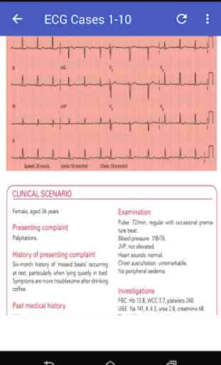 Learn How To Read ECG 2