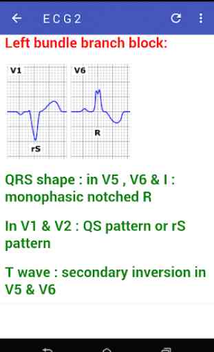 Learn How To Read ECG 3