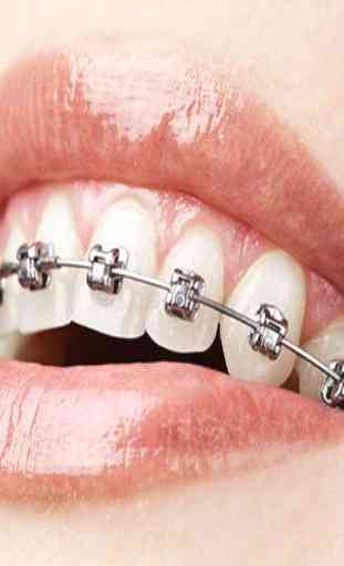 Orthodontic (Guide) 1