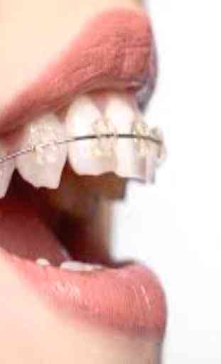 Orthodontic (Guide) 2