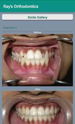 Rays Orthodontics 4