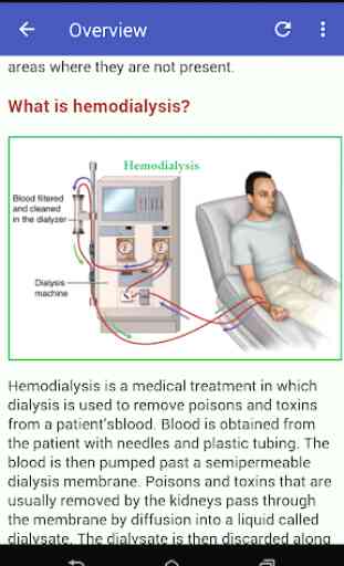 Kidney Dialysis Guide 3