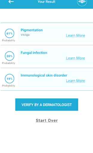Analyze skin problems | AI Skin Symptom Checker 4