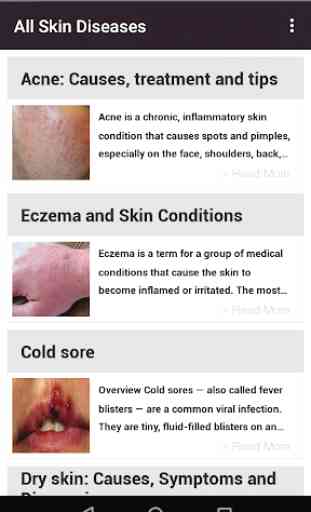 Toutes les maladies de la peau et les traitements 1