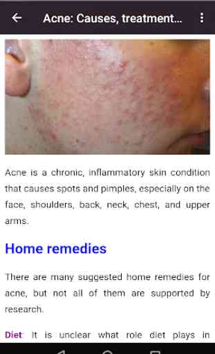 Toutes les maladies de la peau et les traitements 3