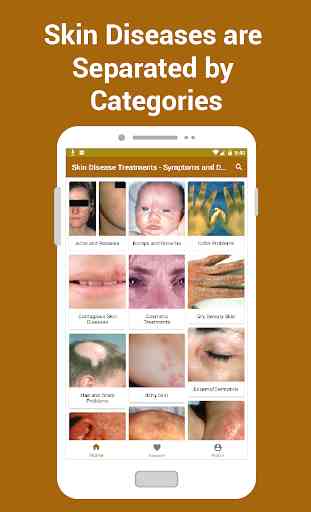 Traitements des maladies de la peau - Symptômes 2