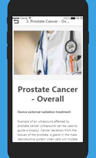 Prostate Cancer Treatment 3