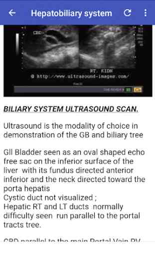 Abdomino-Pelvic Ultrasound Guide 2