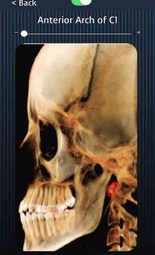 Dental Panoramic Radiology 4