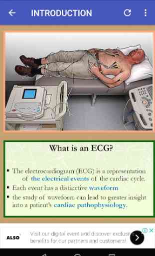 Clinical ECG Interpretation an A - Z Approach 4