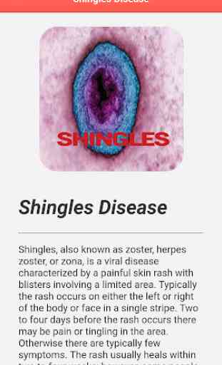 Shingles Disease 4