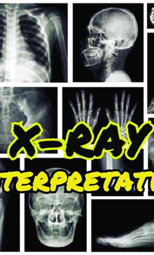 x-ray interpretation guide 1
