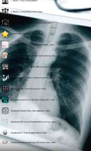 X-Ray -Medical XRay Interpretation with 100+ Cases 2