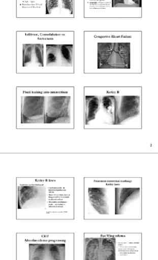 X-Ray -Medical XRay Interpretation with 100+ Cases 3