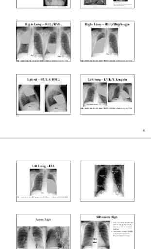 X-Ray -Medical XRay Interpretation with 100+ Cases 4