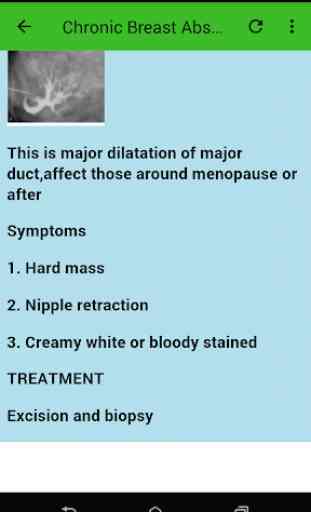 BREAST MASTITIS AND TREATMENT 2