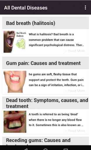Toutes les maladies dentaires 1