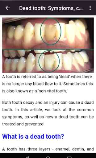 Toutes les maladies dentaires 4
