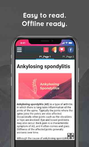 Ankylosing Spondylitis Info 2