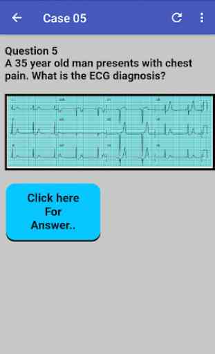 ECG Cases 3