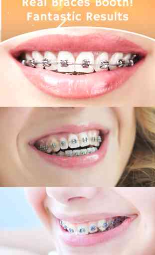 Teeth Braces Photo Maker- Braces Camera Editor 3