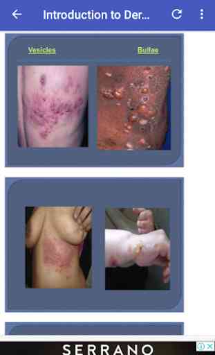 Basics of All Skin Diseases 1