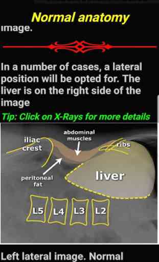 Easy Abdominal X-Ray 2