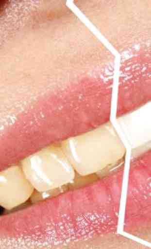 Home Remedies for Yellow Teeth 1