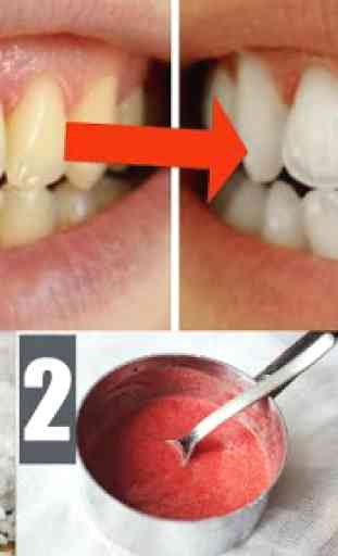 Home Remedies for Yellow Teeth 2