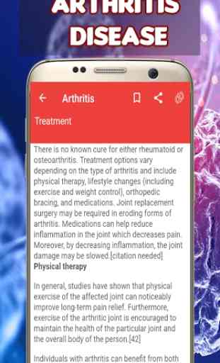 Arthritis: Causes, Diagnosis, and Treatment 1