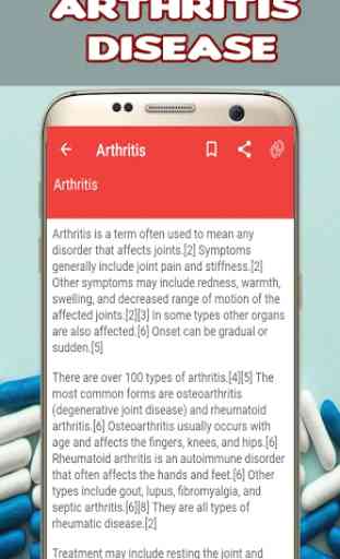 Arthritis: Causes, Diagnosis, and Treatment 2