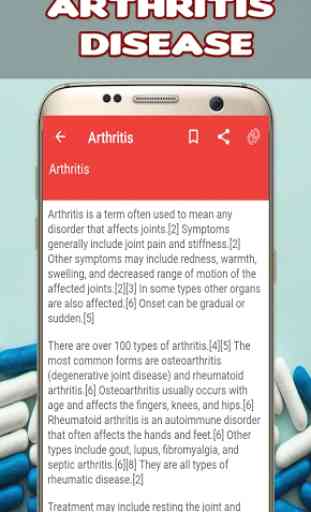 Arthritis: Causes, Diagnosis, and Treatment 4