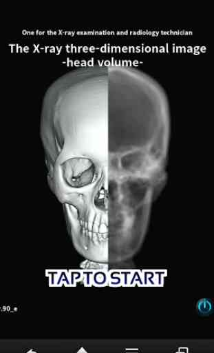 X-ray 3D images -head volume- 1