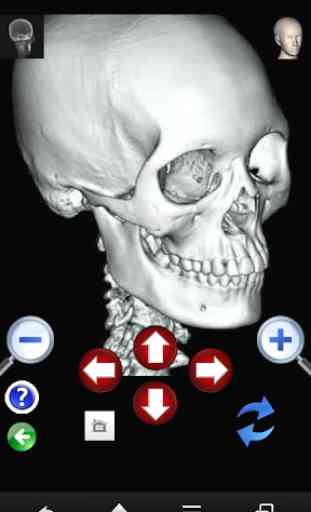X-ray 3D images -head volume- 4
