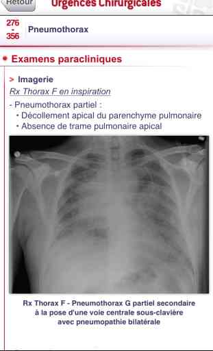 SMARTfiches Urgences Chirurgicales 3