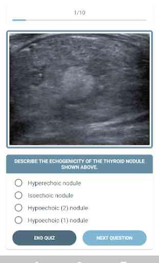 Thyroid Nodules - Ultrasound Guide 3