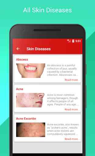 Skin Doctor - All Skin Diseases and Treatment 1