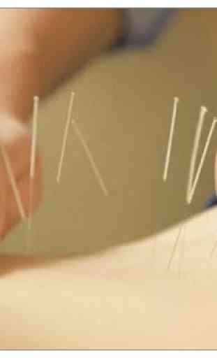 Cours d'acupuncture initial. 1
