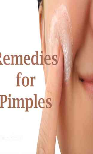 Remedies for pimples 1