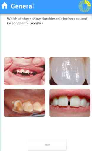 Dentoblast - Dentistry Quiz MCQ 3
