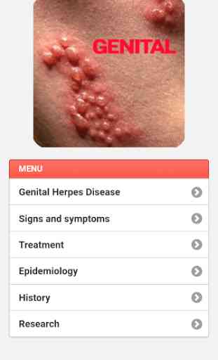 Genital Herpes 2
