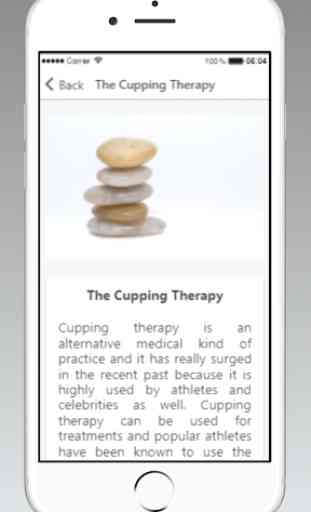 Cupping Therapy Guide 2
