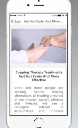 Cupping Therapy Guide 3