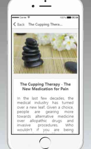 Cupping Therapy Guide 4