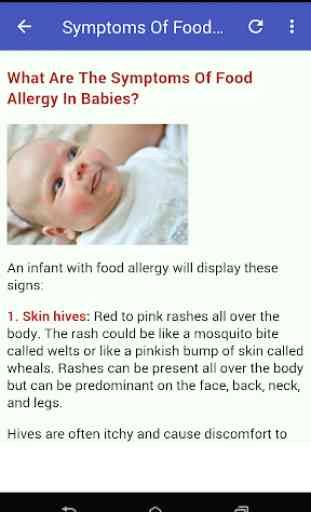 Baby's Food Allergies 2