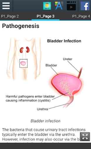 Urinary Tract Infection Info 3