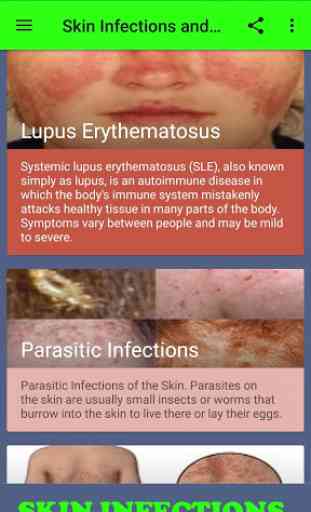 All Skin Infections & Treatments - Diseases Atlas 3