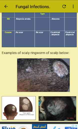 Dermatology (Colored) - Complete Guide 4