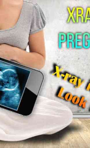 Xray Scanner Prank enceinte 1