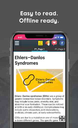 Ehlers–Danlos Syndromes 2